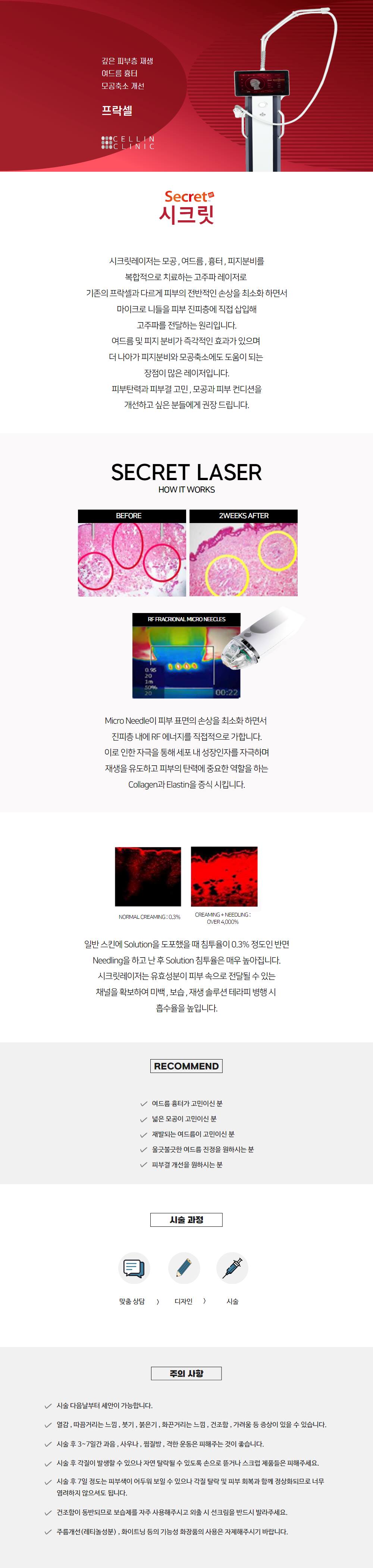 랜딩이미지